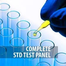 Gloved hand placing a sample into a test tube with ‘Complete STD Test Panel’ text, illustrating comprehensive screening for multiple sexually transmitted diseases when syphilis is diagnosed, used for patient education by OC MedDerm