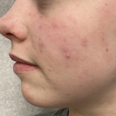 Medical Dermatology In Irvine, Orange County, CA