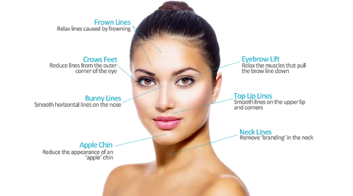 Frequently injected areas with Botox or Dysport - OC MedDerm